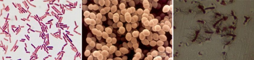 Escherichia makilak, entreokoko fecal eta pro - bakterioen prostatitis kronikoaren patogeno nagusiak